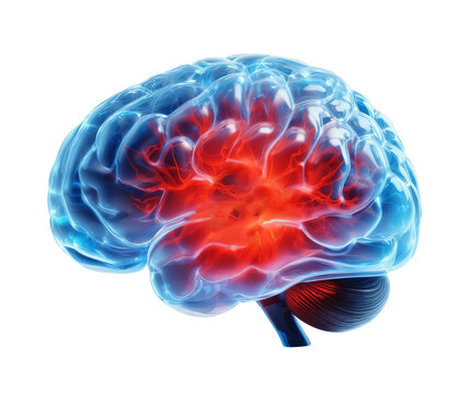 Migraine, headache, brain 3d style, isolated, transparent PNG