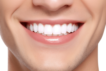 Close-up of Senior woman perfect white teeth with a shade guide the bleach color isolated on transparent background.