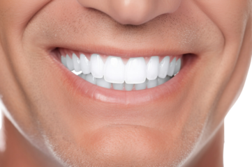 Close-up of Senior male perfect white teeth with a shade guide the bleach color isolated on transparent background.