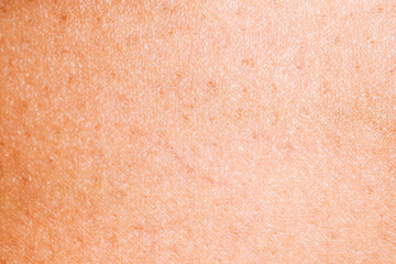 human skin background texture
