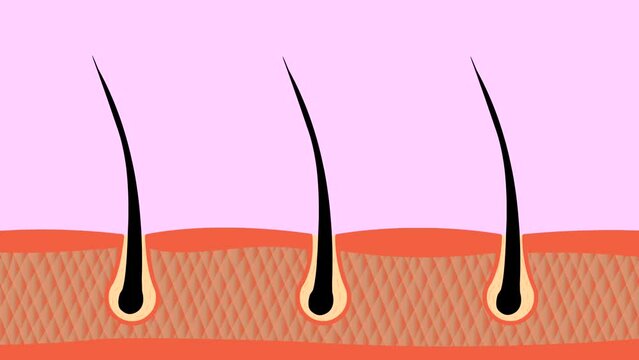 Animation of growing black strands of hair on human skin, art, 2d animation, drawing, biology, human body, science.