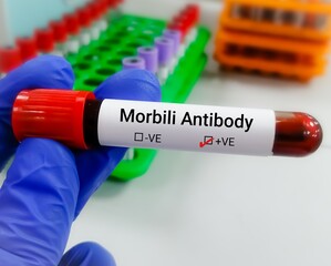 Blood sample for Morbilli Antibody test, measles 