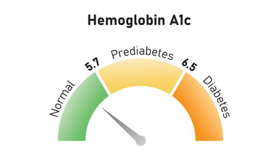 Hemoglobin A1c Test Levels Concept Design. Vector Illustration.