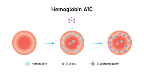 Hemoglobin A1c Scientific Design. Vector Illustration.	