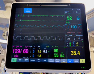 Hospital monitor displaying vital signs: heart rate, blood pressure, oxygenation, temperature, and end-tidal CO2, crucial for patient care and health assessment