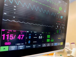 Hospital monitor displaying vital signs: heart rate, blood pressure, oxygenation, temperature, and...