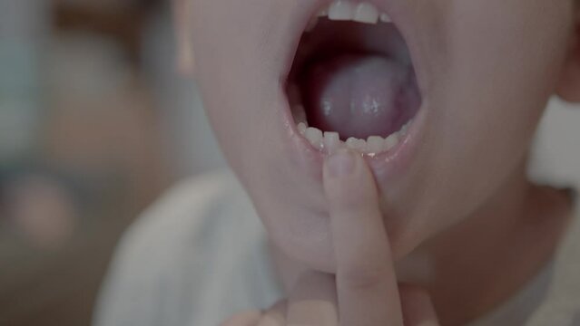 Missing tooth. Close up on a smiling kid showing milk tooth missing and growing permanent adult tooth. High quality 4k footage
