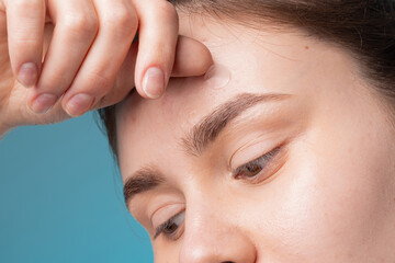 Girl with acne stick round acne patch on her cheek. Using acne patches for treatment of pimple and...