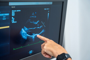 Cardiology clinic with a new ultrasound machine for echocardiogram exams to clients, female doctor...