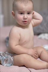 Roseola is the beginning of the course of the disease in the baby, there are barely noticeable...