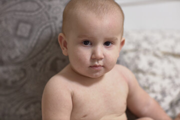 A baby's rash, a rash on the skin, a harmless non-dangerous viral infection caused by two strains...