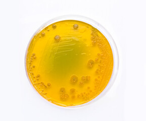 Vibrio alginolyticus colonies growing in a petri dish with Thiosulfate Citrate Bile Salts Sucrose (TCBS) agar medium 