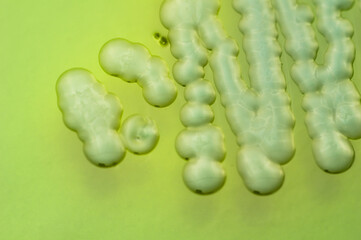 macro view of Vibrio parahaemolyticus colonies growing in a petri dish with Thiosulfate Citrate...