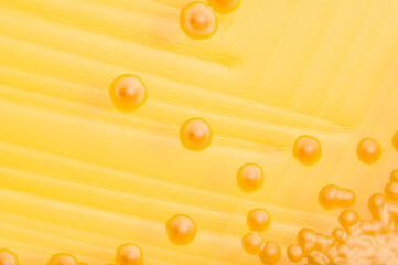 Vibrio cholerae, macro view of colonies growing in a petri dish with Thiosulfate Citrate Bile Salts...