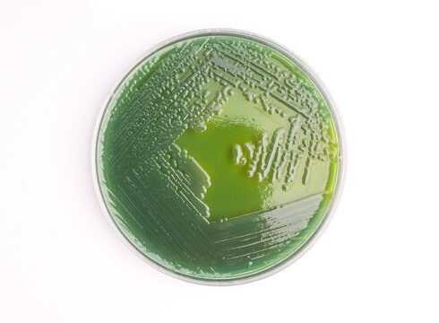 Vibrio parahaemolyticus colonies growing in a petri dish with Thiosulfate Citrate Bile Salts Sucrose (TCBS) agar medium