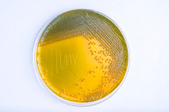 Vibrio cholerae colonies growing in a petri dish with Thiosulfate Citrate Bile Salts Sucrose (TCBS) agar medium