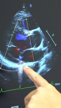 Cardiology clinic with a new ultrasound machine for echocardiogram exams to clients, female doctor pointing at the monitor