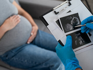 Gynecologist looks at an ultrasound of a pregnant woman. 