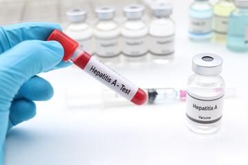 Hepatitis A test to look for abnormalities from blood