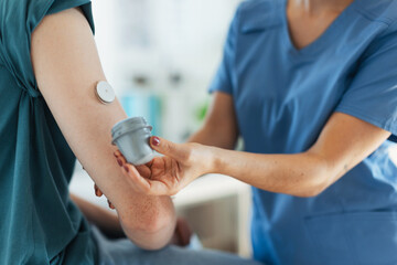 Nurse applying a continuous glucose monitor sensor on arm of a diabetic teenager. CGM device making life of teenage boy easier, helping manage his illness and focus on other activities. - obrazy, fototapety, plakaty