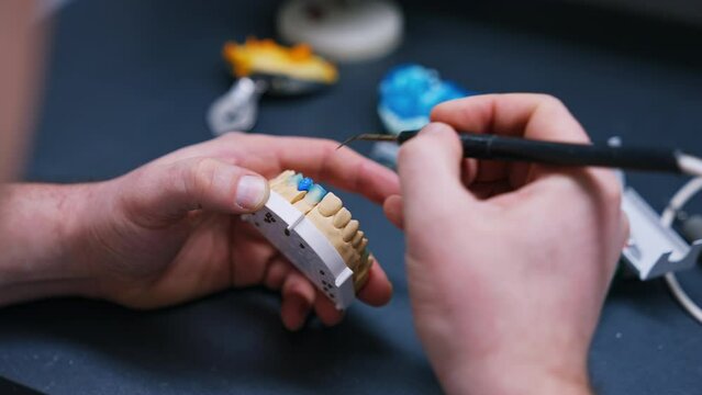 Male hands hold the denture model. Professional uses a tool for teeth implantation. Close up.