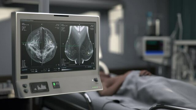 Breast Screening Exam Of Patient In Advanced Medical Laboratory By X-ray Scanner. Screening To Evaluate Health. Healthcare Exam. Laboratory Analysis. Screening Diagnostic Exam In Clinic Laboratory