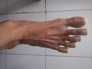 Feet of a 50 year old asian.