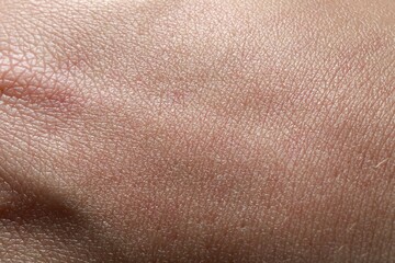 Naklejka premium Closeup view of dry human skin as background