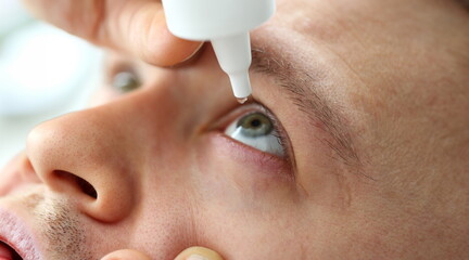 Man putting liquid drops in his eye solving vision problem closeup