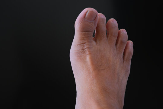 Close up shot of a man's right foot over dark background