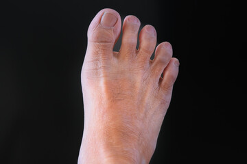 Close up shot of a man's right foot over dark background