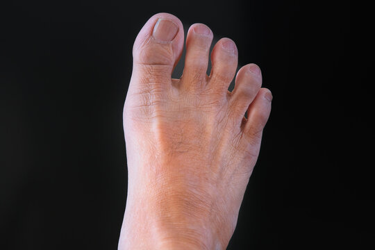 Close up shot of a man's right foot over dark background