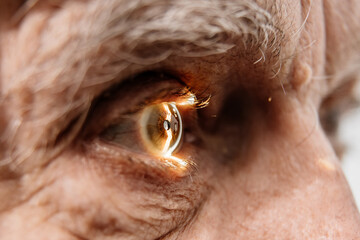 Close-up of an eye on an ophthalmology examination of an elderly man. The concept of advertising...