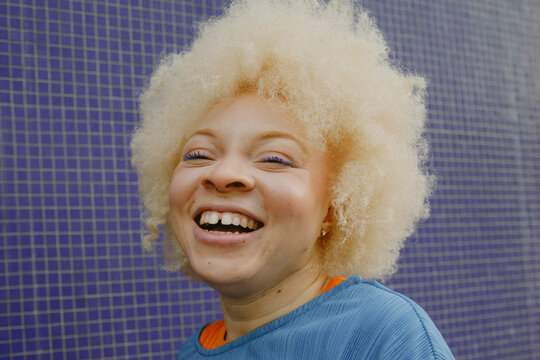 Closeup portrait of young woman with albinism in front of blue wall smiling into camera