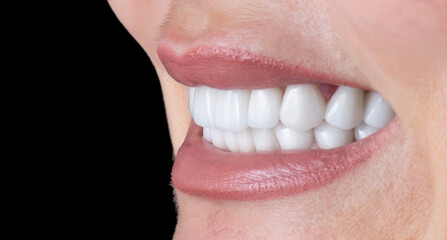 dental treatment pictures