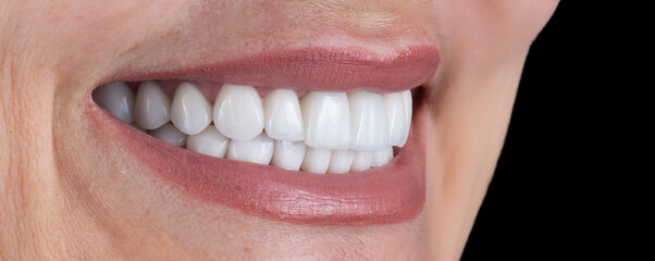 dental treatment pictures