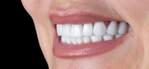 dental treatment pictures