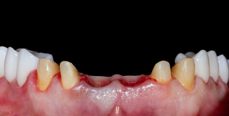 dental treatment pictures