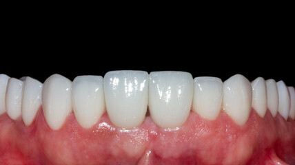 dental treatment pictures