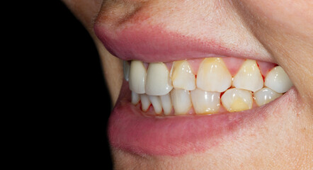 dental treatment pictures
