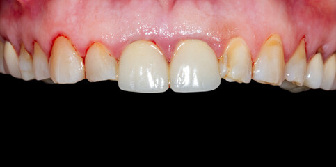 dental treatment pictures