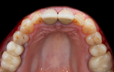 dental treatment pictures