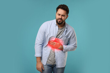 Man suffering from stomach ache on light blue background. Illustration of unhealthy...