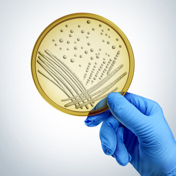 Hand Holding A Petri Dish as a scientist or biologist with a cultured growth of fungus as a science symbol for researching microbiology as Deadly Fungal Infection or mold microbe as a Mycology concept