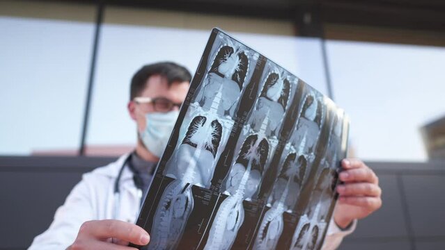 Doctor examines CT scan of chest and abdomen. X-ray or mri for the diagnosis of diseases in pulmonology, lung pathology, inflammatory diseases of bronchi, tuberculosis, covid 19 or coronovirus.