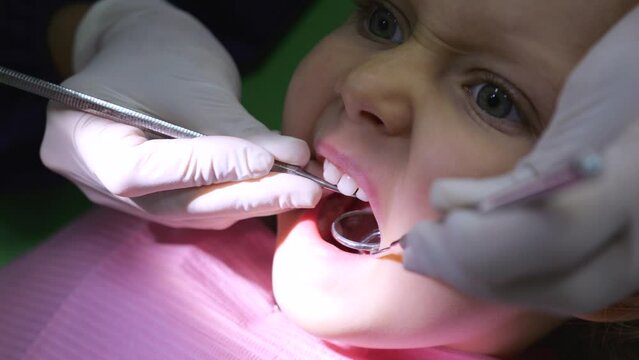 Close-up of scared girl with open mouth sitting in dentists chair. Pediatric dentist looks for dental caries using dental mirror and probe. Concept caries prevention will help avoid dental treatment.
