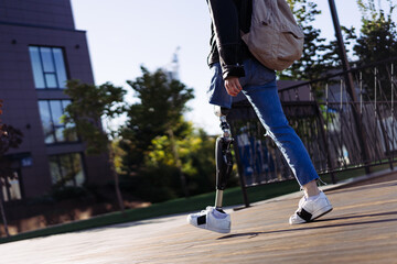 Close up of woman student with prosthetic leg walking in university campus. Woman with bionic leg....