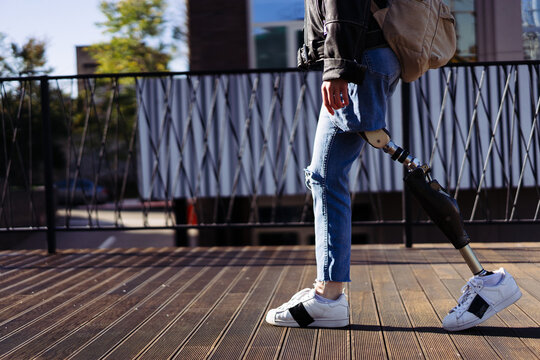 Close up of woman student with prosthetic leg walking in university campus. Woman with bionic leg. Woman with leg prosthesis equipment