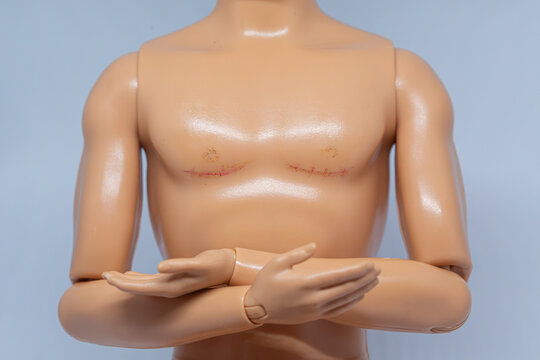 MNICHOVO HRADI&Scaron;TĚ, CZECHIA - NOVEMBER 22, 2023: Barbie Ken doll as a concept for trans masculine person with scars after top surgery