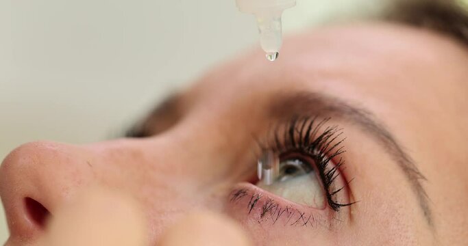 Woman dripping medicinal drops of natural tears into eyes